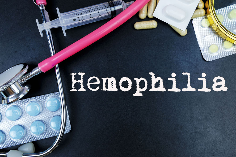 5 Signs That Indicate Hemophilia