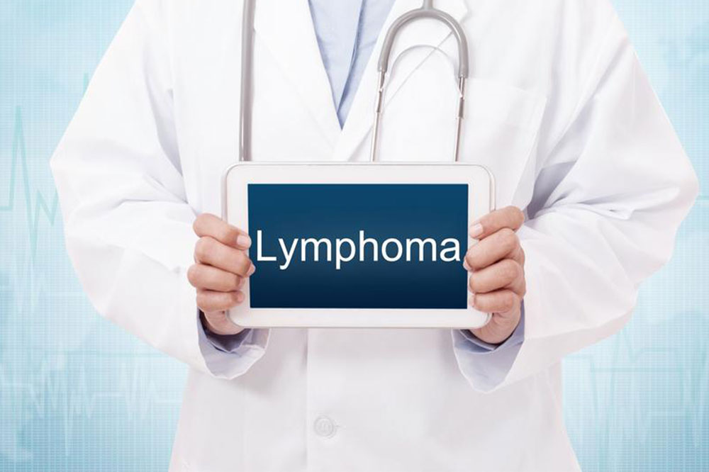 Common Risk Factors of Lymphoma