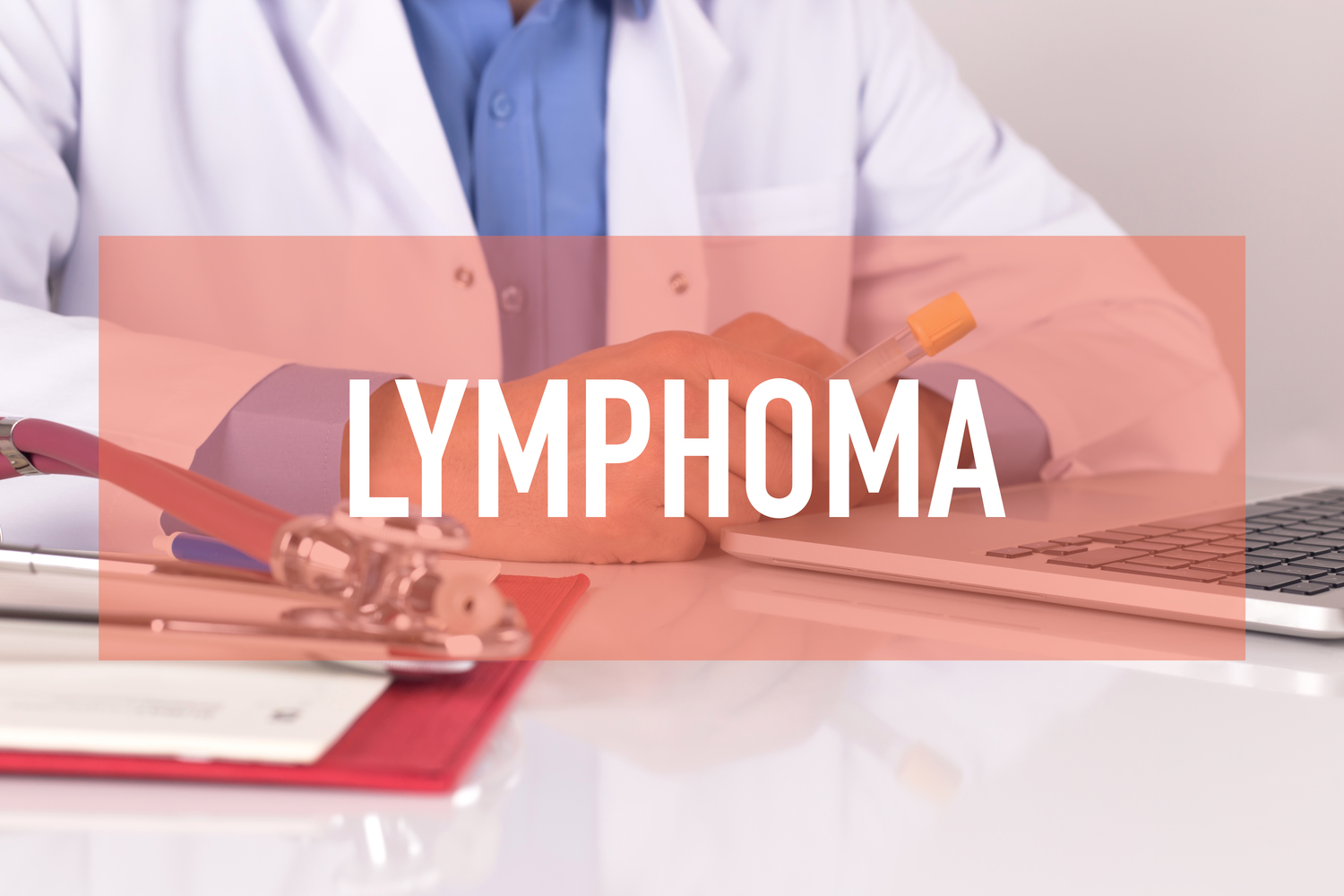 Causes and Risk Factors for Non-Hodgkin’s Lymphoma